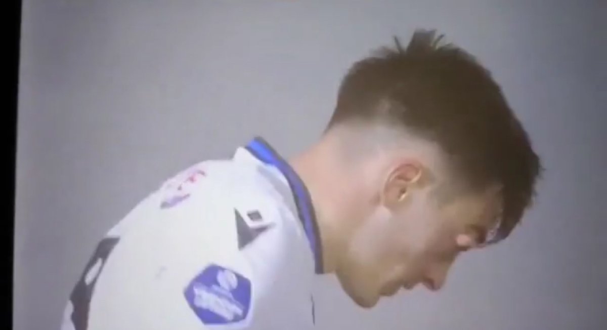 У молдавского футболиста почти выпал глаз во время матча