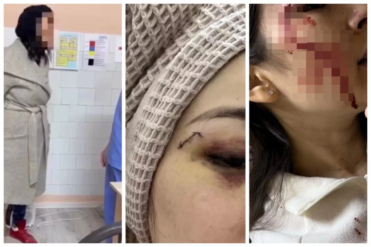 Кеудесін тістеп, шап тұсынан ұрған: Алматыда науқас дәрігерлерге шабуыл жасаған