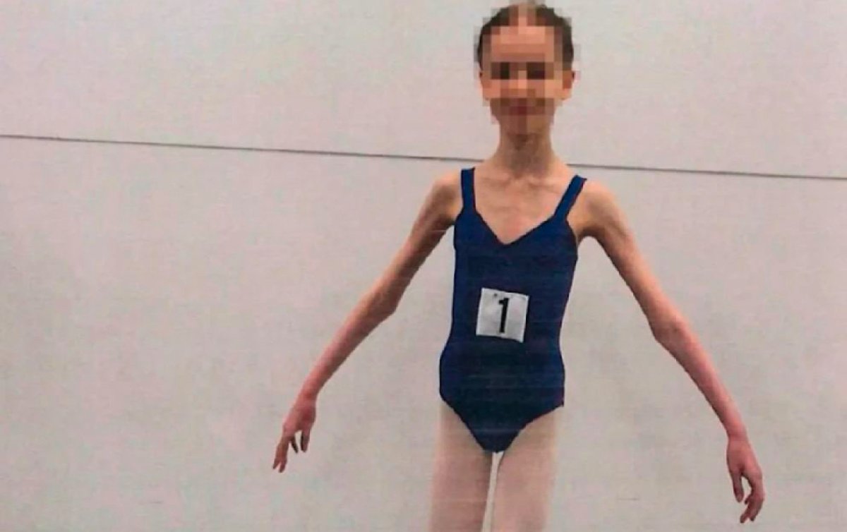 Родители довели дочь-балерину до истощения