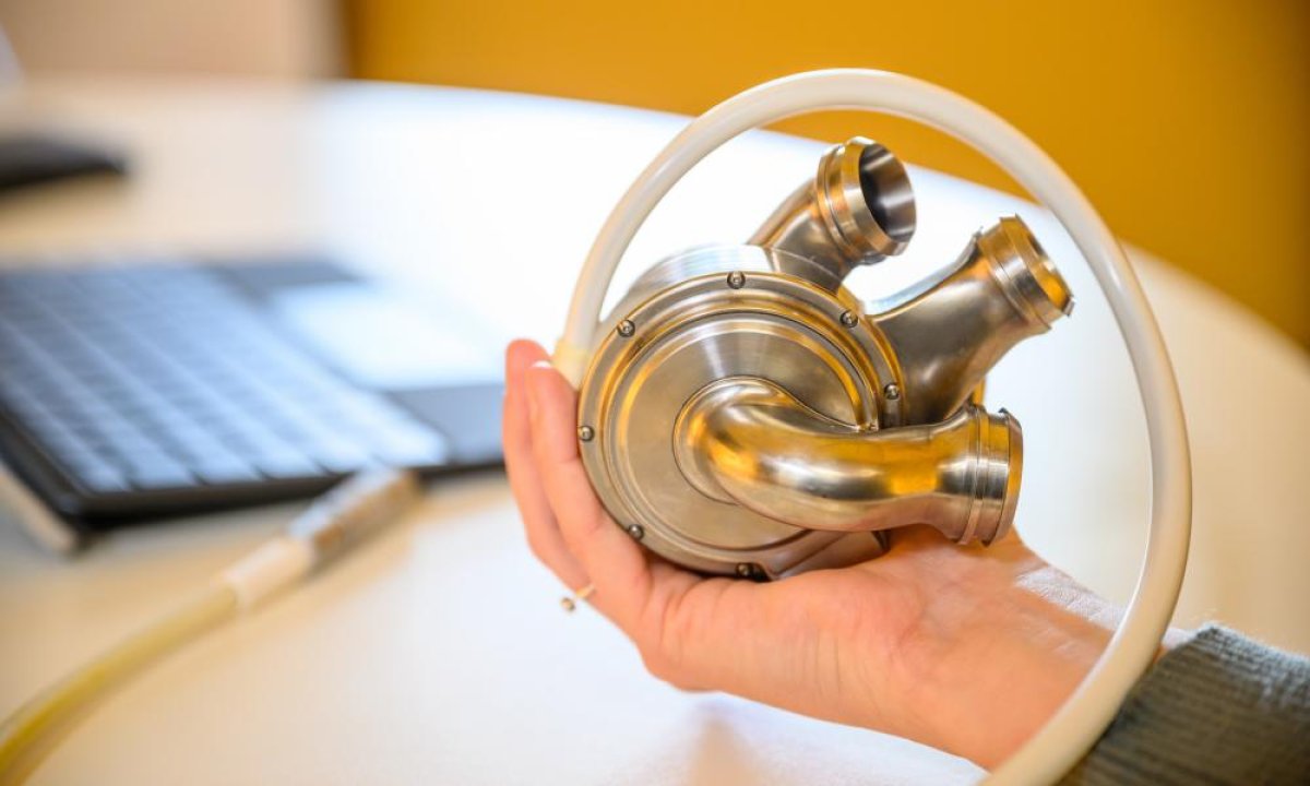 «Абсолютный клинический успех»: мужчина прожил с искусственным сердцем 100 дней