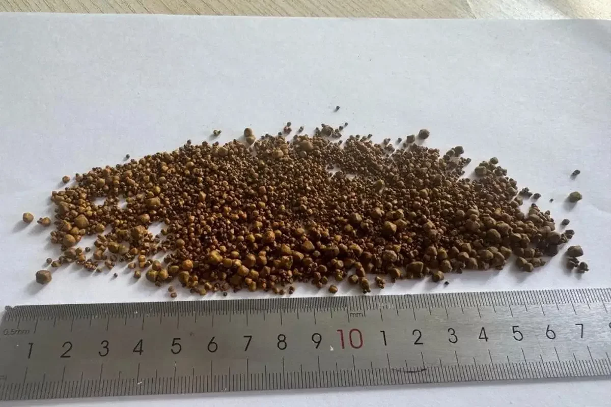 Алматы дәрігерлері қырық жастағы ер адамның өтінен 5499 тас алып шыққан