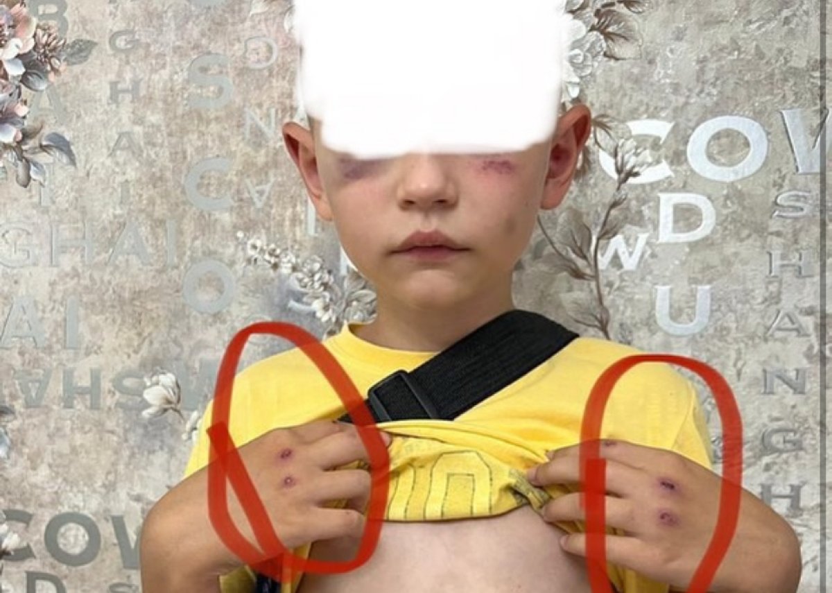 8-летнего ребёнка избили в Лисаковске