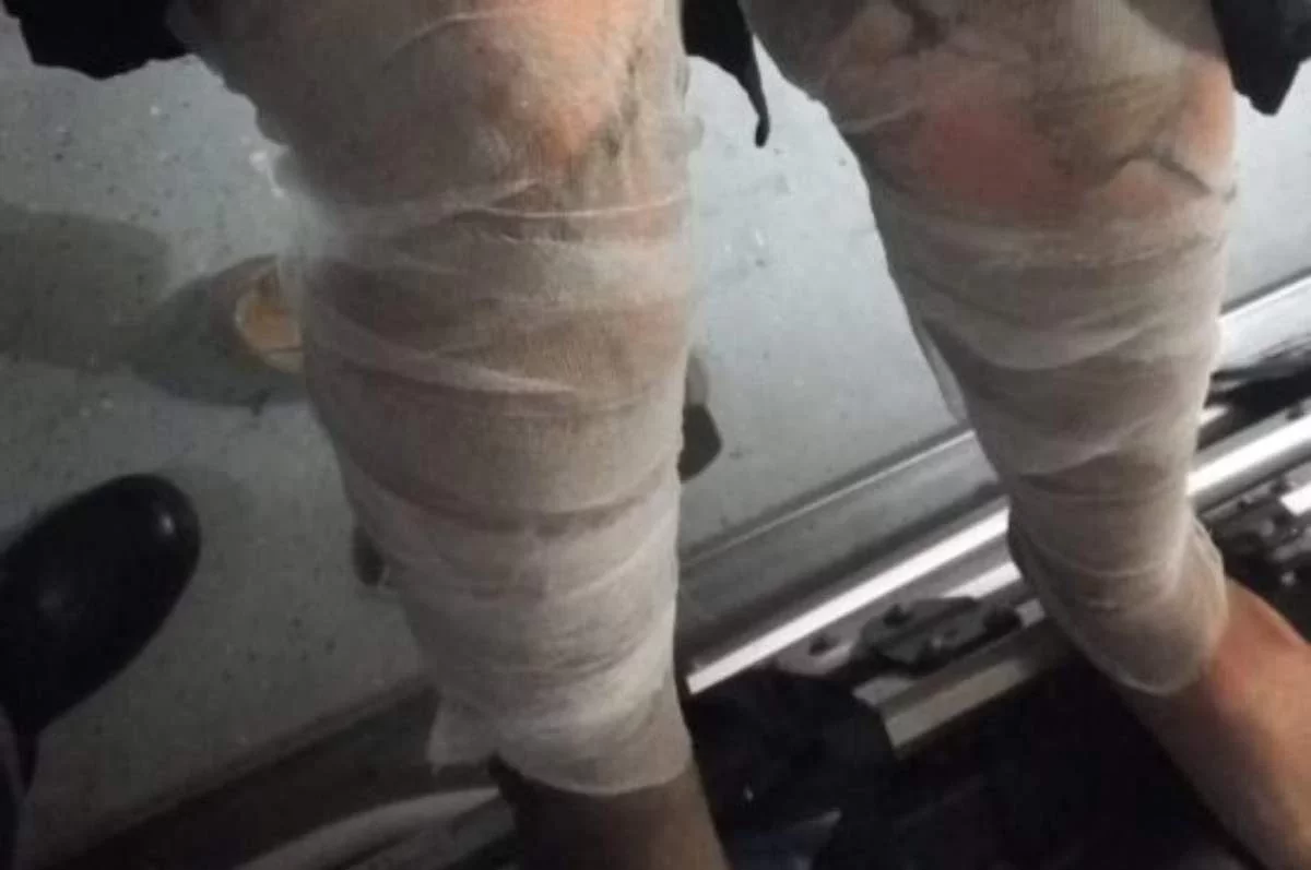 Павлодарда көлік өртеніп, бес адам зардап шекті
