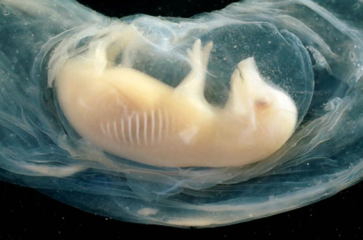 Ученые вырастили крошечные человеческие сердца в эмбрионах свиньи.