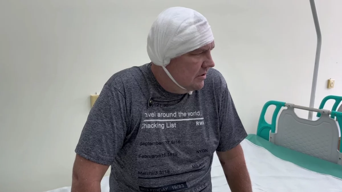 Гигантскую опухоль головного мозга удалили пациенту врачи в СКО