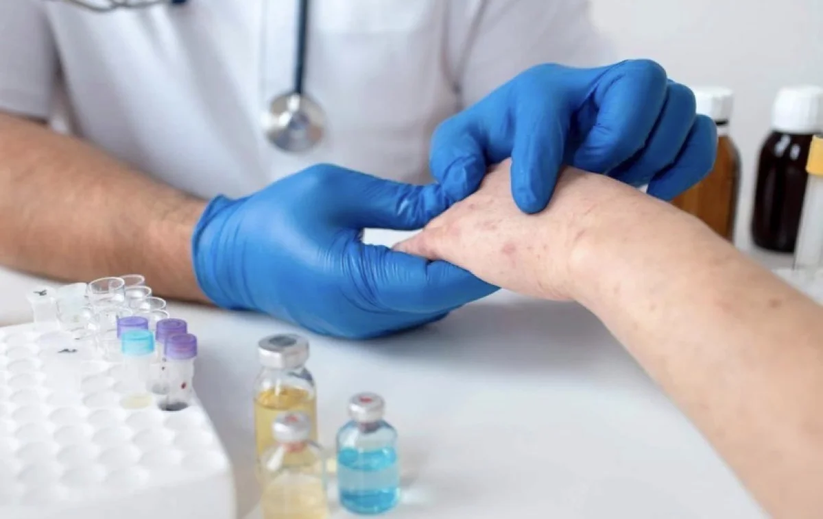 В Астане с начала года зарегистрировано почти 400 случаев кори