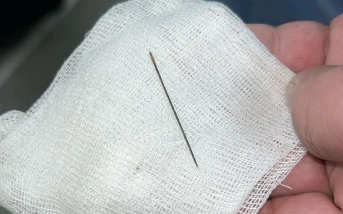 8 айлық сәбидің ішінен ине шықты