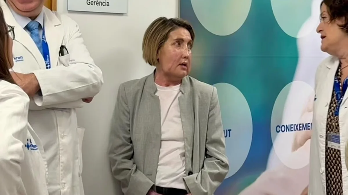 Первую пересадку лица от донора после эвтаназии провели в Испании