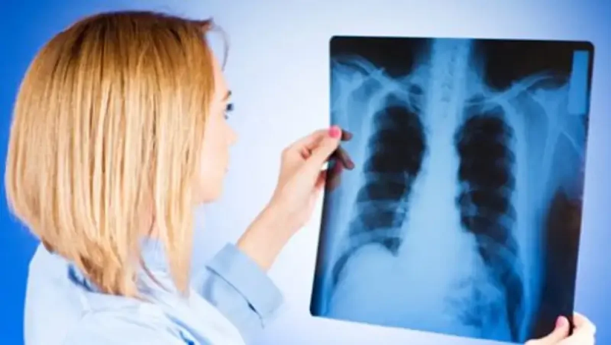 Туберкулезге шалдыққандар азайды