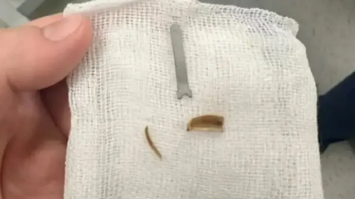 11 айлық сәбидің өкпесінен металл табылды