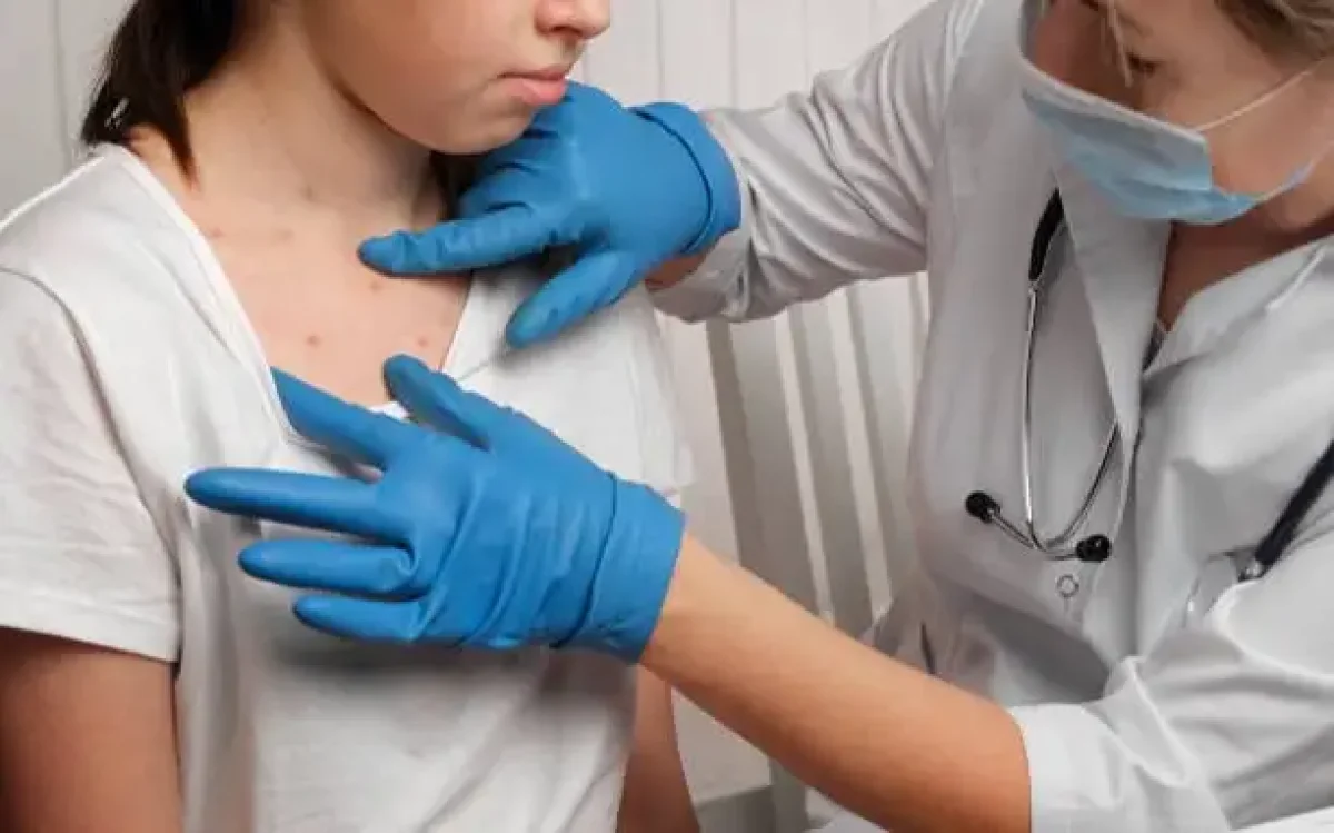 Орал қаласында скарлатинамен сырқаттанғандар саны 1,3 есеге көбейген