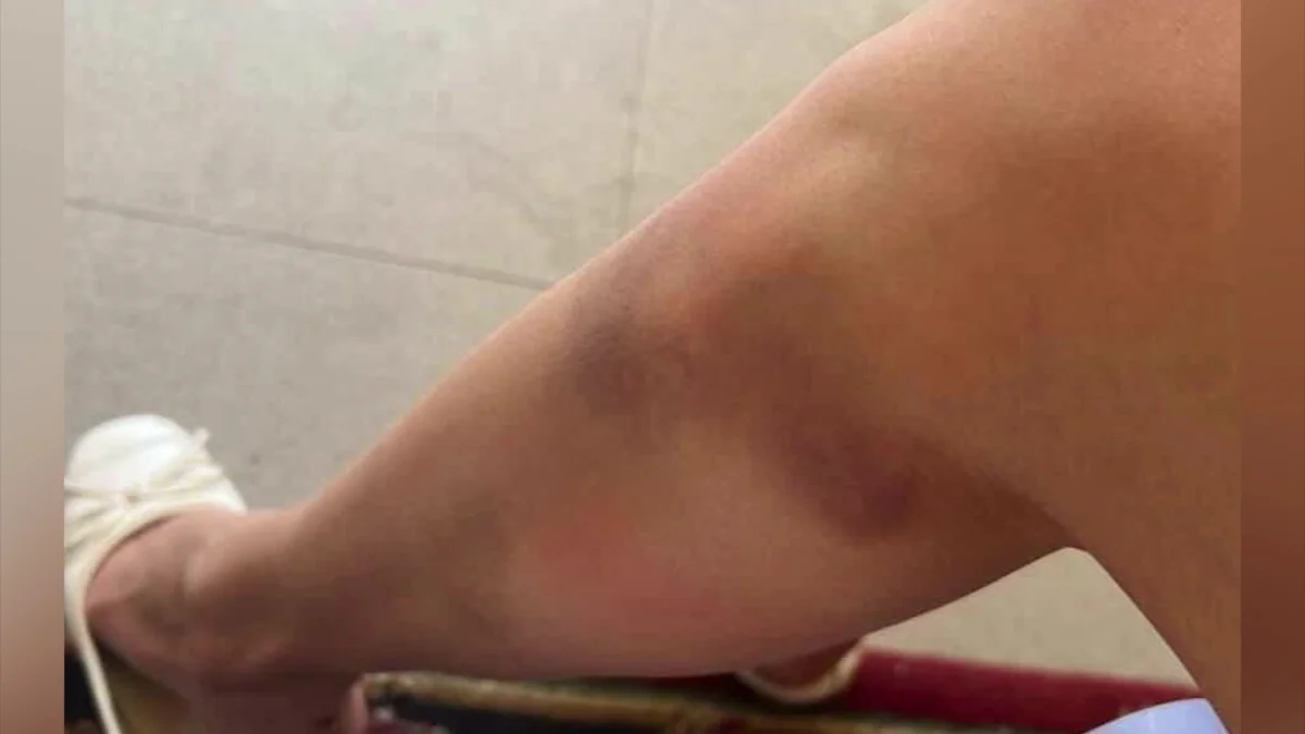 Сталкингке ұшыраған алматылық әйел көмек сұрайды