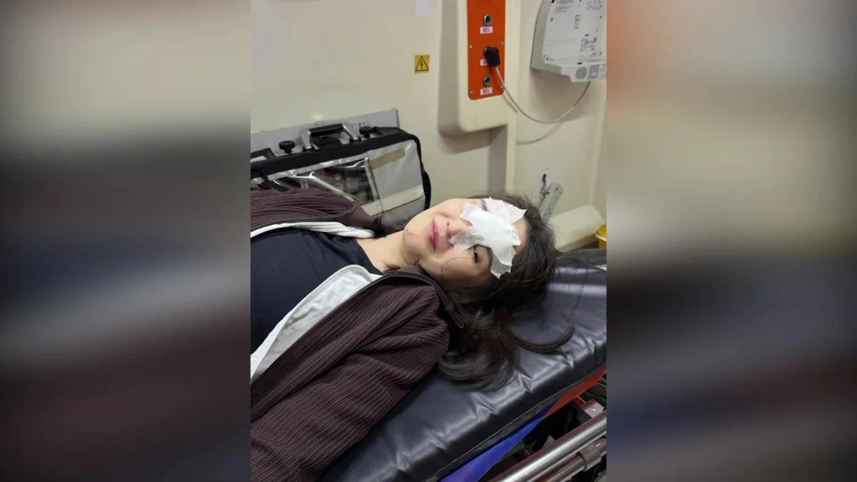 Болельщица получила травму на футбольном матче в Актобе