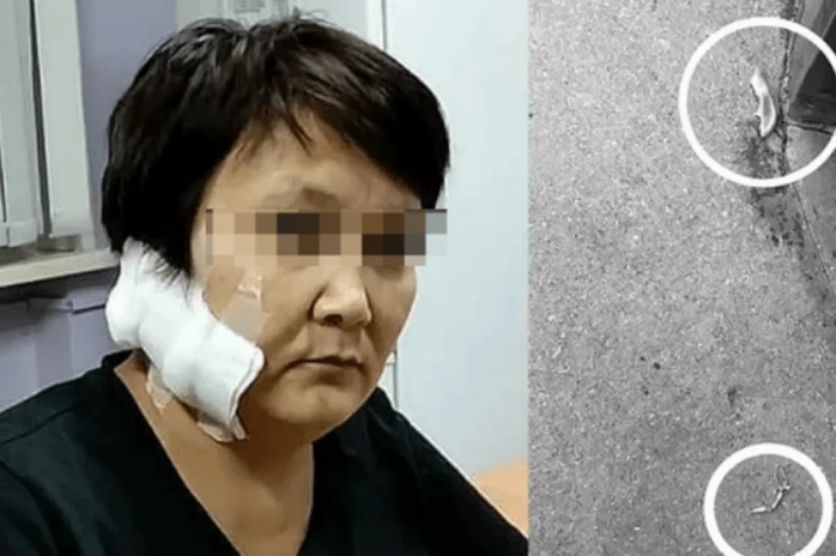 В ВКО арестовали мужчину после жестокого нападения на бывшую жену