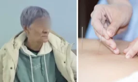 Жительнице Усть-Каменогорска проткнули лёгкое во время иглоукалывания