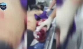 Школьник из Ташкента остался без пальцев после взрыва пиротехники