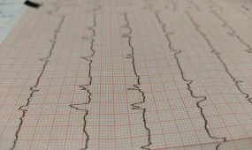 4500 казахстанцев нуждаются в пересадке органов