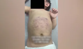 3-летнюю девочку избил собственный отец в области Жетысу: ребёнок находится в тяжёлом состоянии