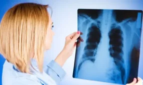 Туберкулезге шалдыққандар азайды