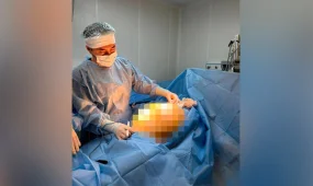 Алматыдағы дәрігерлер науқастан 25 келілік ісікті алып тастады