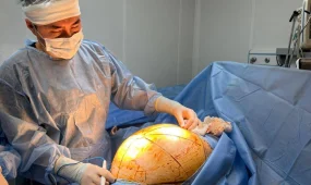 Алматыда дәрігерлер 25 келілік ісікті алып тастады