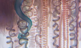 Критические для жизни ожоги научились лечить с помощью морских червей