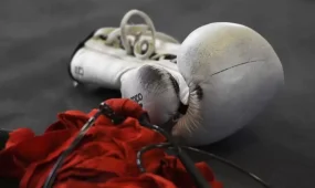 Кениялық боксшы жекпе-жектен кейін ауруханада көз жұмды