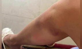 Сталкингке ұшыраған алматылық әйел көмек сұрайды