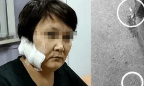 В ВКО арестовали мужчину после жестокого нападения на бывшую жену
