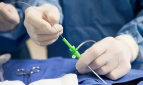 Қызылорда облысында отадан кейін науқастың денесінде дәке қалып кеткен: сот медициналық мекемені кінәлі деп таныды