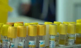 Шымкентте биыл ВИЧ жұқтырған 17 әйел дені сау сәбиді өмірге әкелді