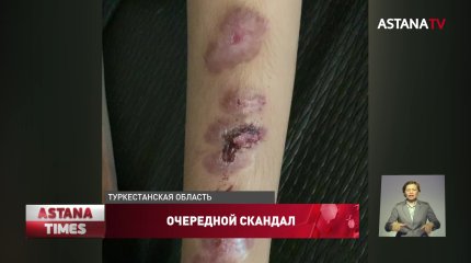 Детей инвалидов "поджарили" на обогревателях в Туркестанской области