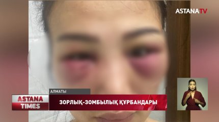 Зорлық-зомбылық құрбаны болған нәзік жандылардың саны азаймай тұр