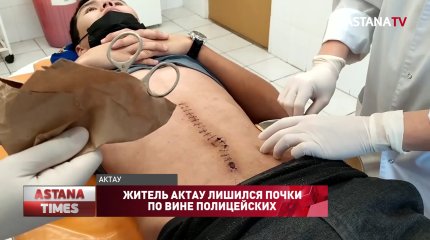 Житель Актау лишился почки по вине полицейских