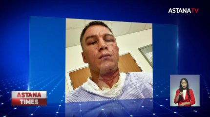 Казахстанского боксера облили кислотой на сборах в Великобритании