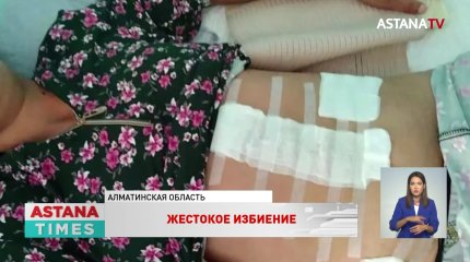 Жительнице Алматинской области удалили селезёнку после жестокого избиения