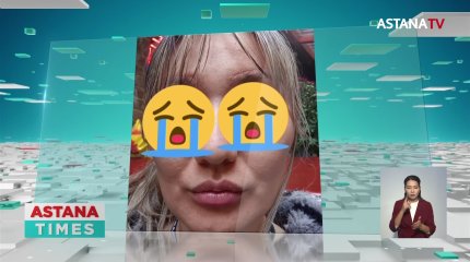 700 мың теңгеге көзіне пластикалық операция жасатқан әйел ел алдына шыға алмай жүр