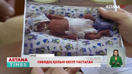 Оралдық дәрігерлер үш айлық сәбидің қолын кесіп тастады