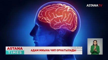 2023 жылдан бастап адамдардың миына чип салынады