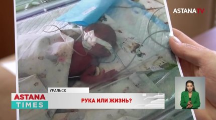 "Иглу не туда воткнули": житель Уральска винит медиков в ампутации руки младенца
