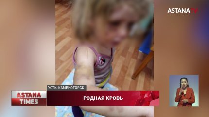 Гнался с ножом: двух маленьких девочек зверски избил родной брат в Усть-Каменогорске