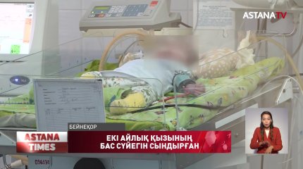 Елорда тұрғыны екі айлық қызын ұрып, бас сүйегін сындырған