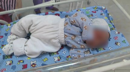 Генетикалық мутацияның салдарынан мүмкіндігі шектеулі балалар саны артты