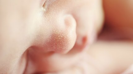 Малыш появился на свет без анального отверстия