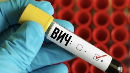 Житель Темиртау проведет почти 7 лет в тюрьме за заражение ВИЧ двух женщин