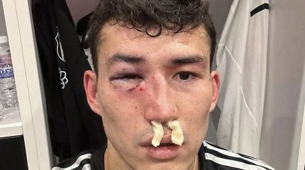 Зайнутдинова покалечили в Турции перед решающим матчем в Казахстане (ВИДЕО)