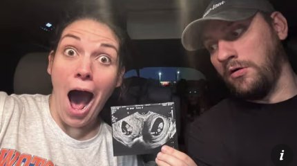 Американка вынашивает детей в двух матках одновременно