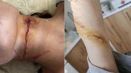 Бывший парень пытался перерезать горло своей экс-возлюбленной в Талдыкоргане