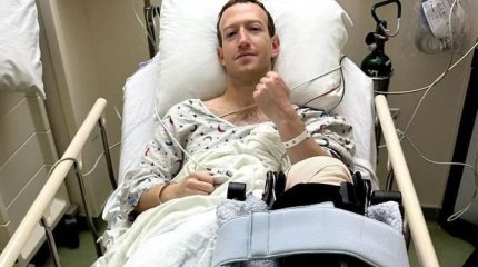 Цукерберг ауруханаға түсті