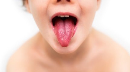 Как защититься от кори, рассказал врач